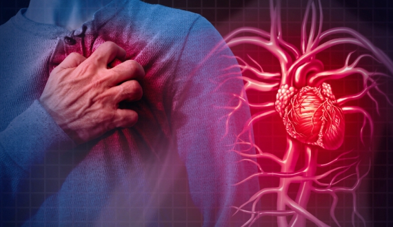 MCC_Website_Images_570x330_2_Myocardial Infarction